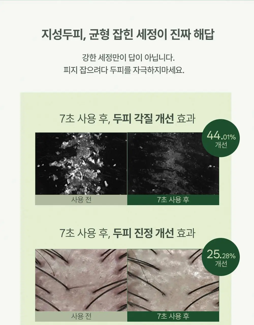 [약산성/두피진정] 헤드스파7 프레쉬 앰플 샴푸 500ml (탈모증상완화) 상세페이지 9
